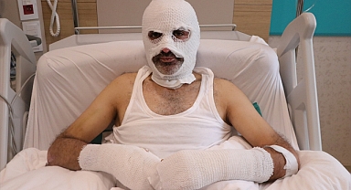 Grip yüzünden gaz kaçağını fark etmedi! Tüpü yakınca canından oluyordu!