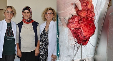 Vücudundan 8 saatte çıkardılar