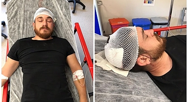 Basın mensubuna çekiçle saldırdı!