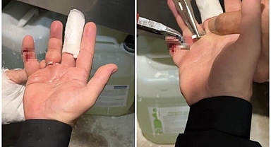 Az kalsın parmağından oluyordu!