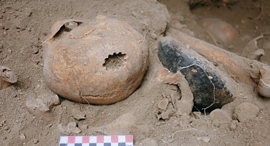 M.Ö. 9. yüzyıla ait... Tıpta tarihi buluş