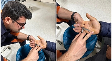 Parmağından oluyordu, yardımına itfaiye koştu