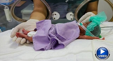 500 gramlık bebeğin hayata tutunma çabası