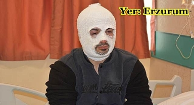 Bomba gibi patladı; az daha son yemeği olacaktı!