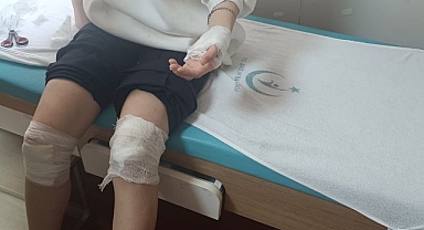 Köpek terörü bitmiyor! Genç kız dehşeti yaşadı