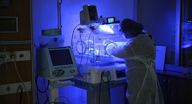 Minik kalplerin hayata tutunması için çabalıyorlar