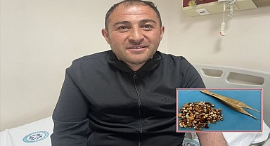 Böbreklerinden 300'ün üzerinde taş çıktı