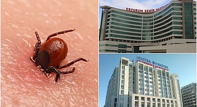 Erzurum'da kene alarmı! 44 vaka, 1 ölü