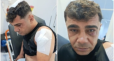 İş görüşmesine gitti saldırıya uğradı