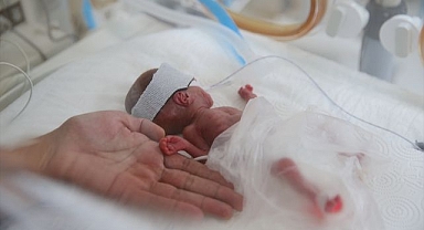 Prematüre bebekler sağlık çalışanlarının çabasıyla hayata tutunuyor