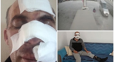 Eniştesine araçla çarpıp kaçtı!