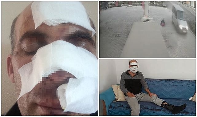 Eniştesine araçla çarpıp kaçtı!