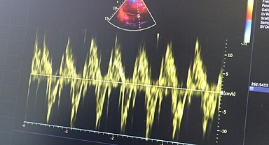 Kalp hastaları soğuk havada daha dikkatli olmalı