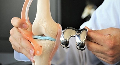 Kireçlenmeye karşı eksozom tedavisi yaygınlaşıyor