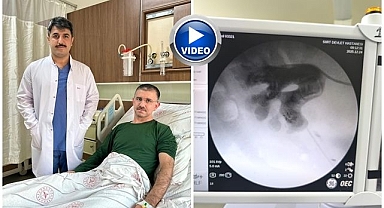 Başka şikayetle gitti... Böbreğinden geyik boynuzu taşı çıktı