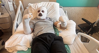 Çay demlemek isterken canından oluyordu! Erzurum'da tedavi altına alındı