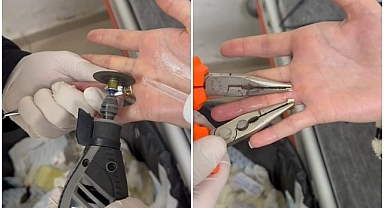 Parmağa sıkışan yüzük için seferber oldular 