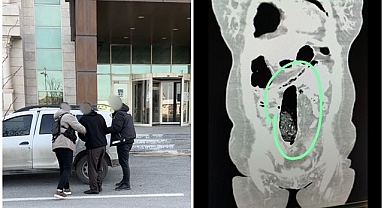 Uyuşturucuyu vücutlarına zulaladılar!