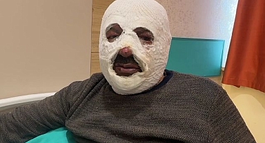 Kalorifer kazanına benzin dökünce olanlar oldu!