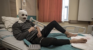 Erzurum'da çakmağını gaz doldururken ölümden döndü!