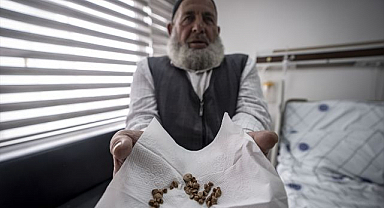 Erzurum'da üreterden 51 taş çıkarıldı, doktorlar bile şaşırdı