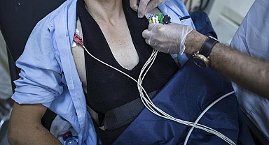 Kalp hastalıklarına karşı basit önlemler hayat kurtarıyor