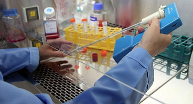 Kanser tedavisinde yeni dönem! Akıllı radyoterapi 