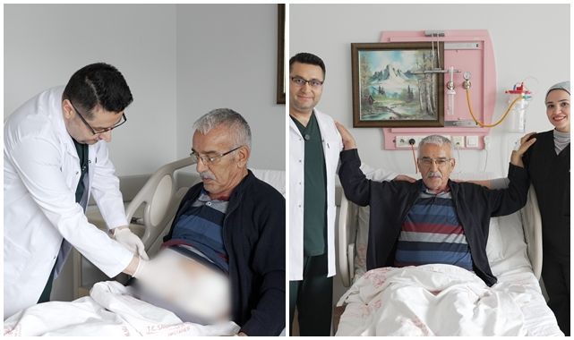 Kapalı yöntemle başarılı kanser ameliyatı