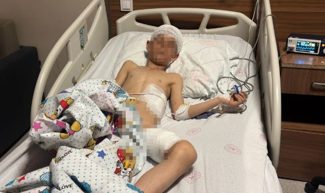 Köpek dehşetinde kan donduran detaylar