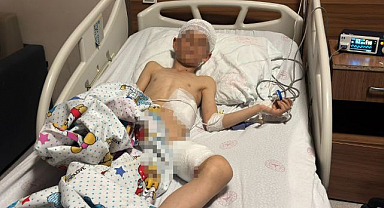 Köpek dehşetinde kan donduran detaylar