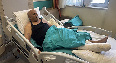 Elektrik akımında bir kolunu kaybetti, 