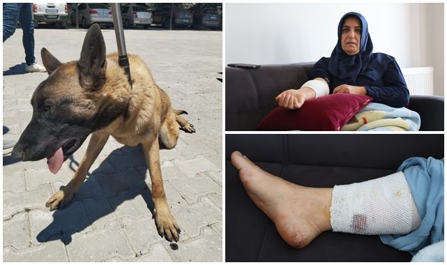 Köpek saldırısına uğramıştı! Talihsiz kadın dehşet anlarını anlattı 