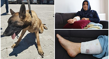 Köpek saldırısına uğramıştı! Talihsiz kadın dehşet anlarını anlattı 