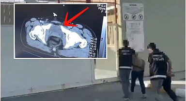 Midelerinde uyuşturucu bulunan 2 şüpheli tutuklandı