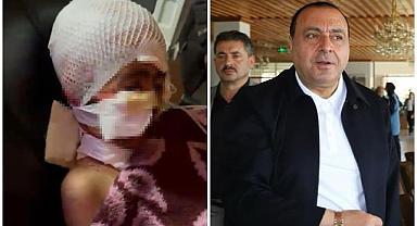 Narman’daki köpek saldırısının faturası belediyeye çıktı