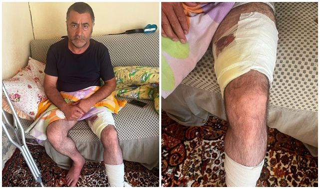 Arazi anlaşmazlığı silahlı kavgaya dönüştü!