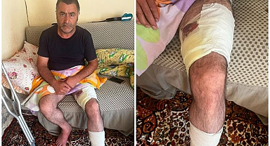 Arazi anlaşmazlığı silahlı kavgaya dönüştü!