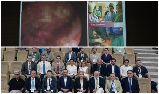 Erzurum'da canlı yayında kapalı kolon ameliyatı   