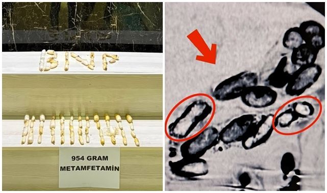 Uyuşturucu taşıma yöntemi pes dedirtti