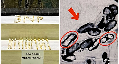 Uyuşturucu taşıma yöntemi pes dedirtti