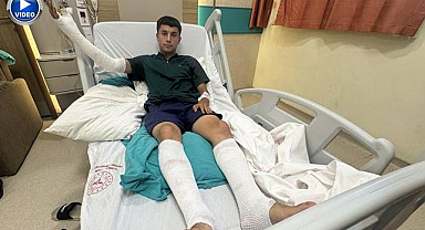 Balata spreyi alev aldı! Temizlik yapan sürücü yaralandı