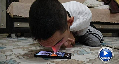 Engelleri burnuyla aştı: Telefonuyla hayata tutundu