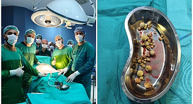 Mesanesinden çıkanlar doktorları da şaşırttı!