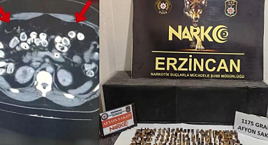 Uyuşturucuyu vücutlarında taşıyan 3 şüpheli yakalandı