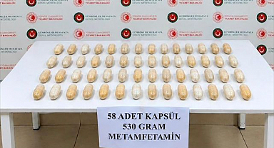 Mide ve bağırsaklarından çıkanlar şoke etti