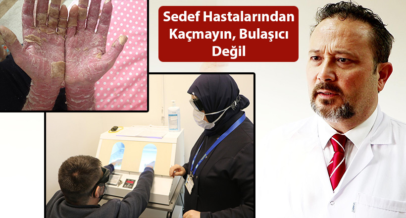 Sedef Hastalarından Kaçmayın, Bulaşıcı Değil