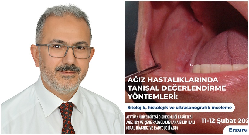 Ağız Hastalıklarında Tanı